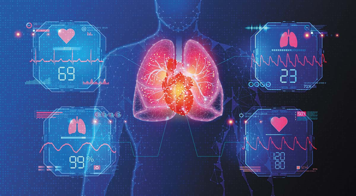 Cardiac AI