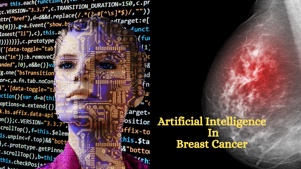 Breast Cancer
